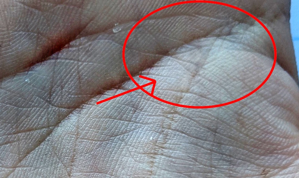 🖐️ Фатальный знак или качества характера? 

Здравствуйте дорогие друзья! Сегодня речь о редком знак