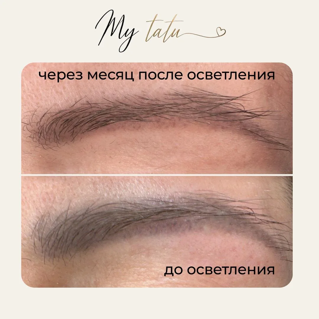 🤍 Когда пигмент устарел