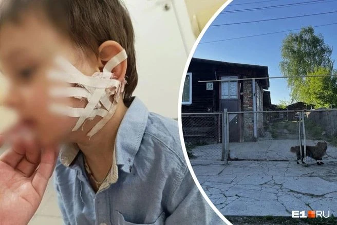 В Кировограде агрессивная собака укусила трёхлетнего мальчика за голову. Животное повалило ребёнка с