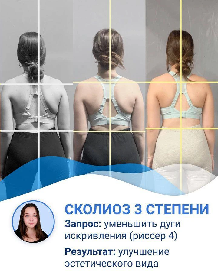 ВЫХОД ВСЕГДА ЕСТЬ, ПРОСТО ИНОГДА ОН ТЩАТЕЛЬНО СПРЯТАН!
⠀
Прежде чем начать работать с этой девушкой,