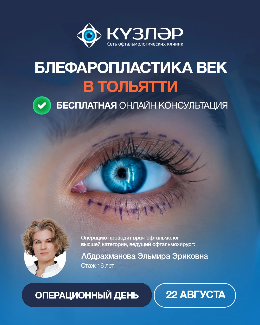 ✨ Блефаропластика в📍Тольятти!

22 августа в нашей клинике пройдет операционный день по блефаропласт
