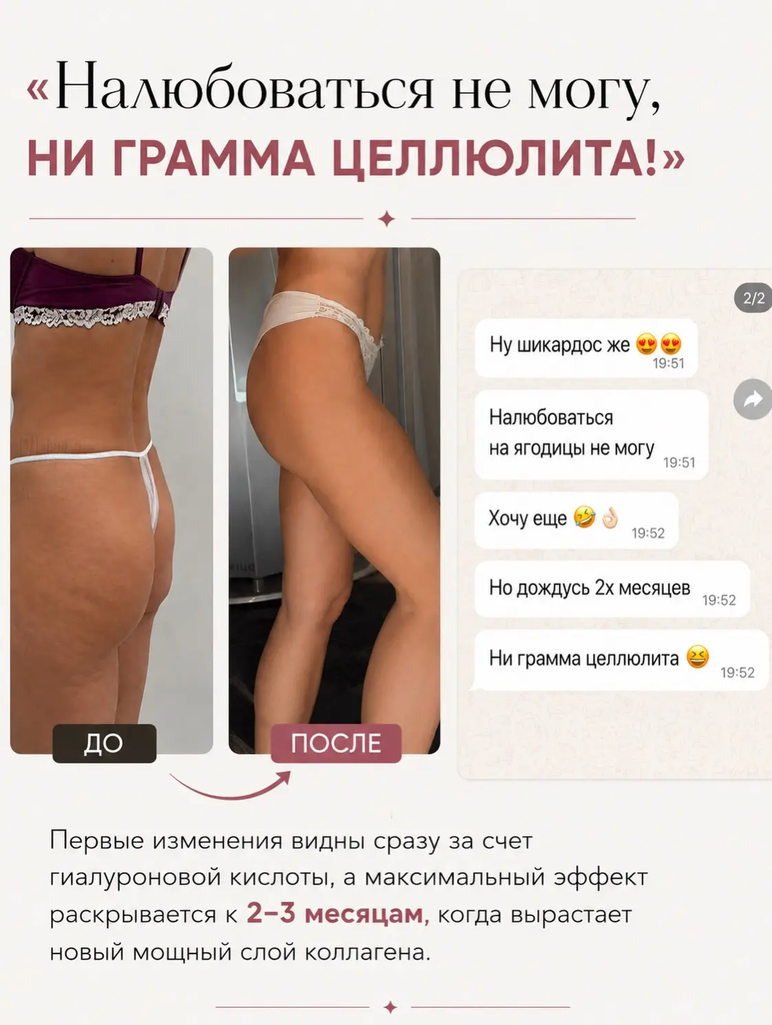 Качать ягодицы в зале — это супер, но что делать, если мышца выросла, а кожа над ней пр...