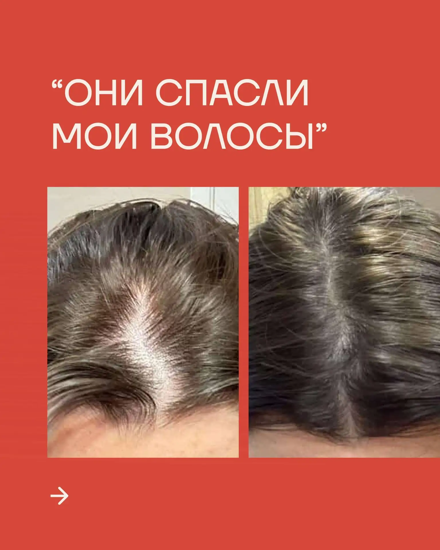 Волосы гуще, длиннее и будто сильнее…

Все благодаря В ФАБАО! Что за средства использовала клиентка 
