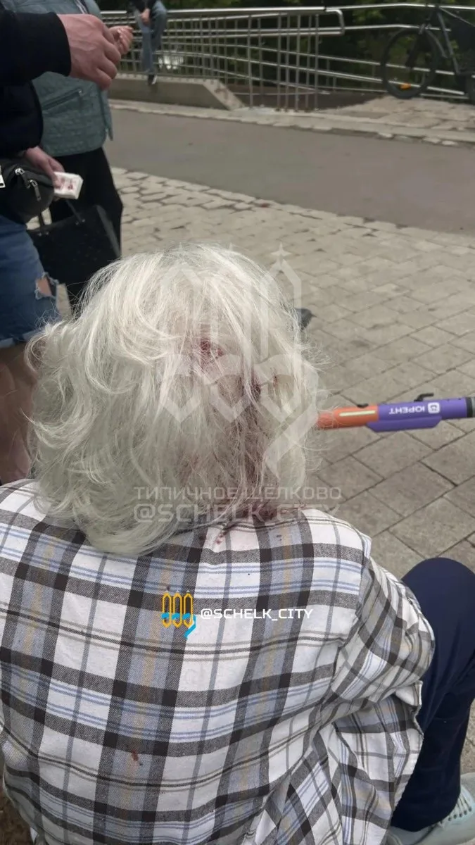 🛴 На Молодёжной набережной два парня несовершеннолетних на самокате сбили бабушку

Очевидцы вызвали