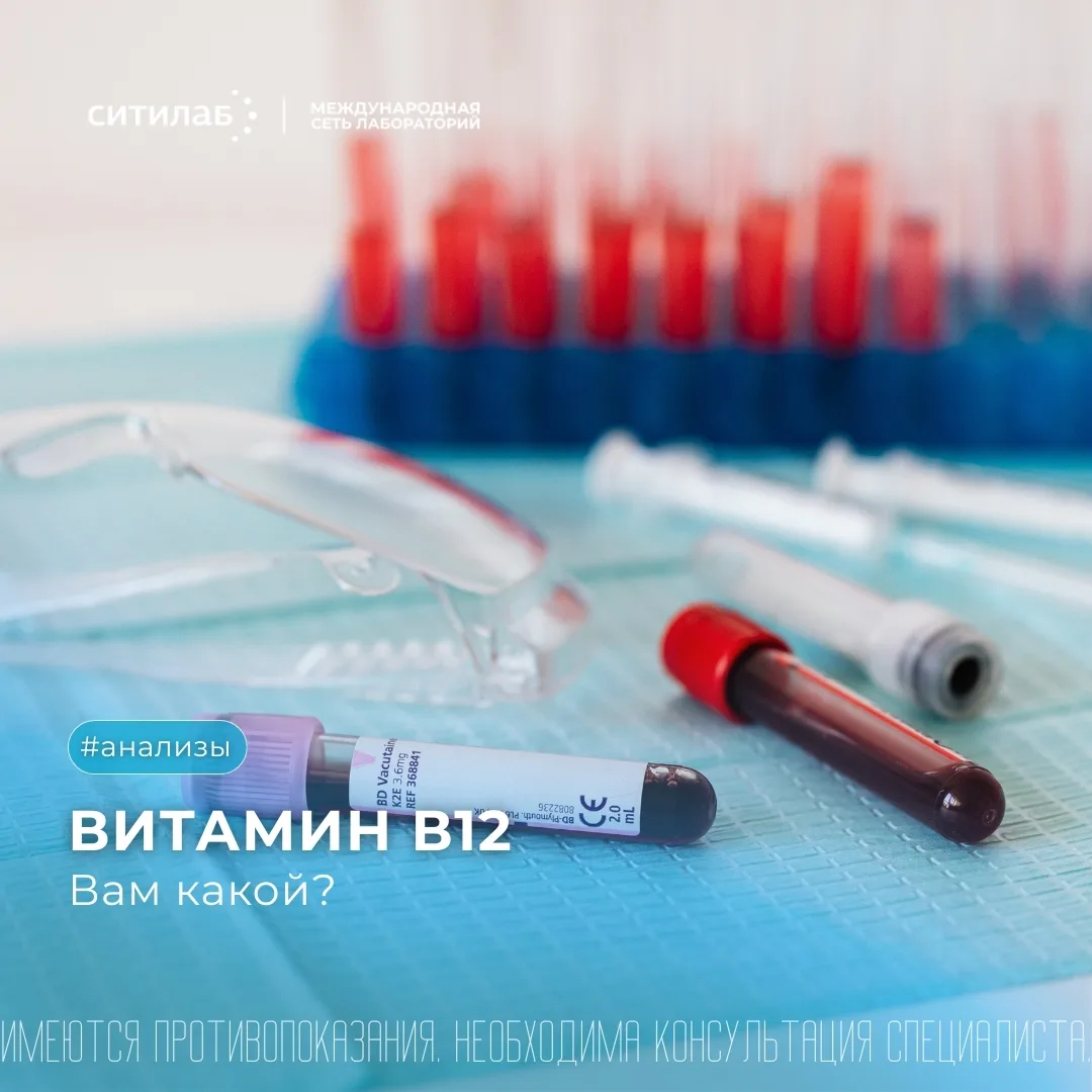 Проверка В12 — хит. Но какой именно сдавать?