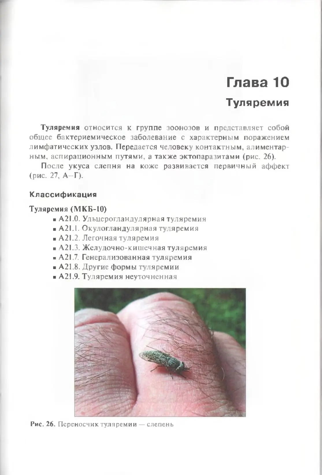 Туляремия (часть 1)