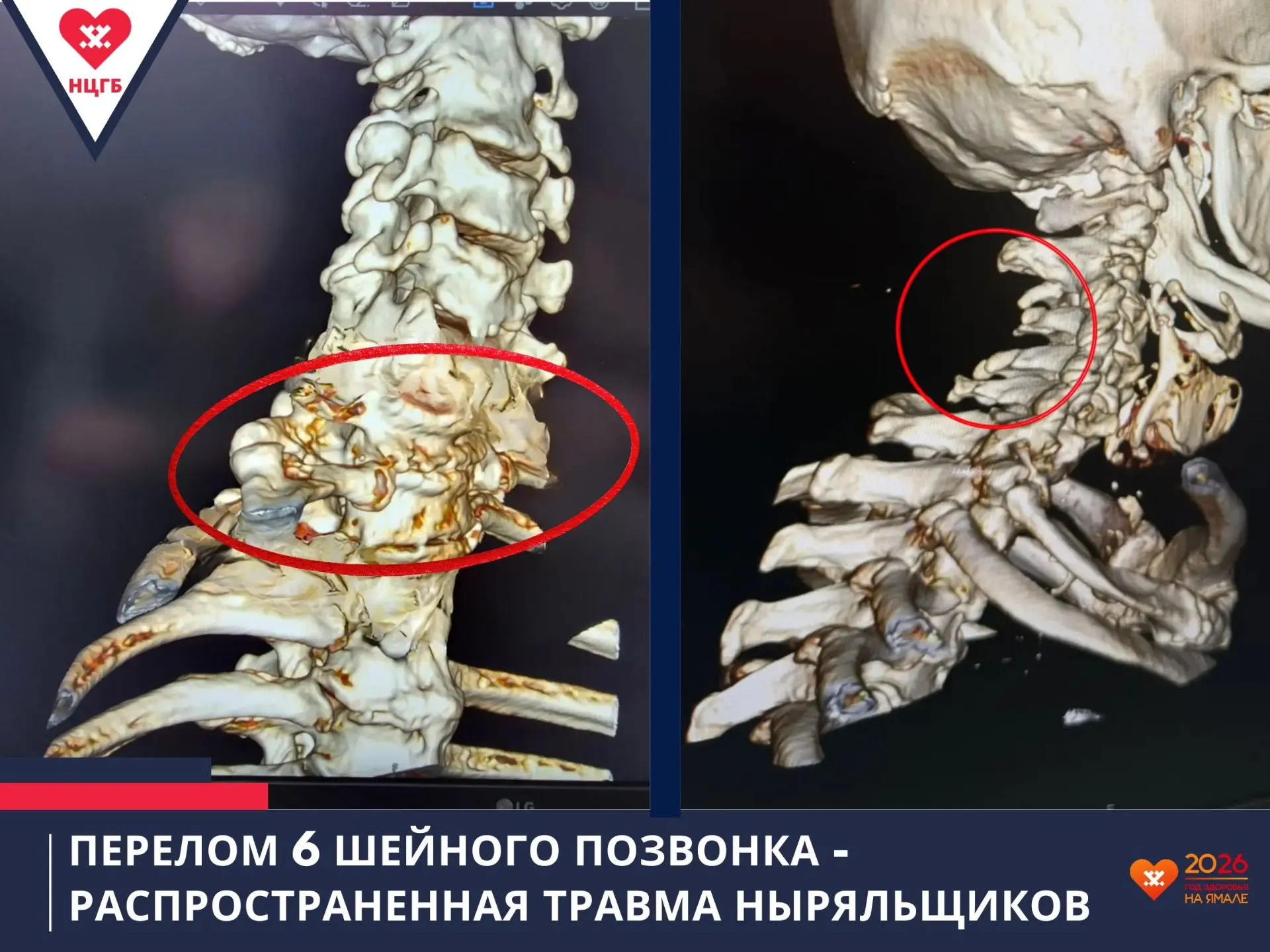 Травмой ныряльщика ознаменовался выход на пенсию 64-летнего мужчины

Начало долгожданного заслуженно