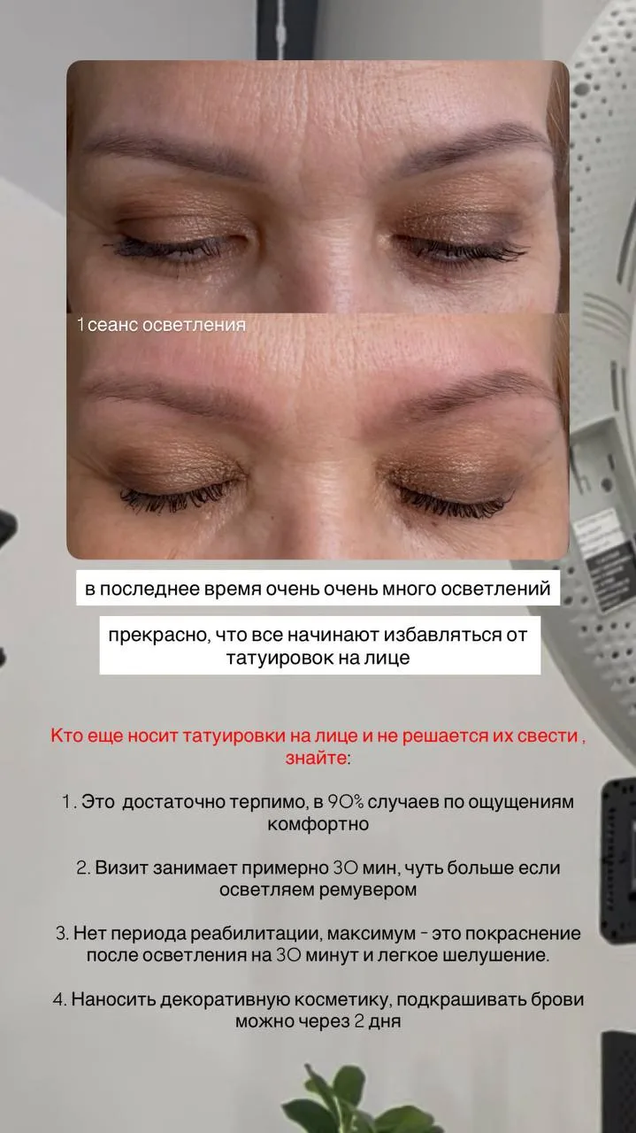 // не бойтесь избавляться от старого перманента/татуажа на лице