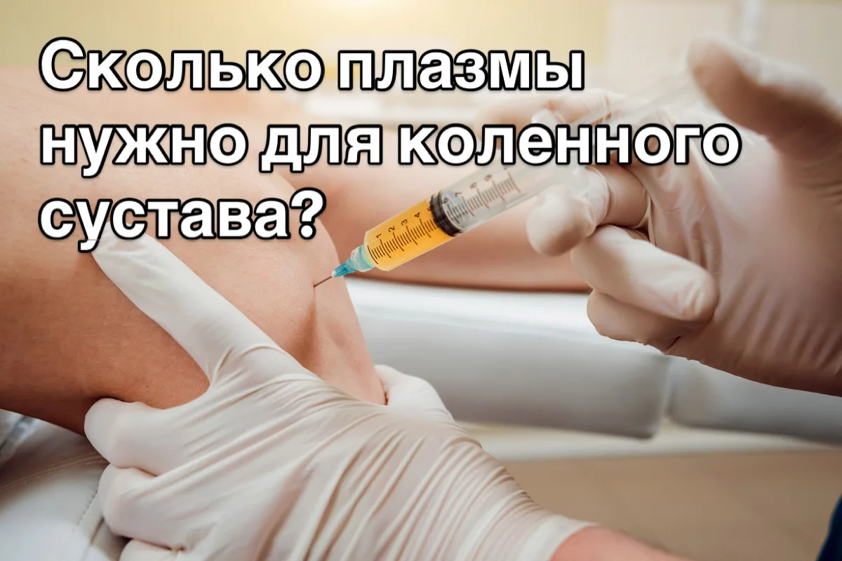 💉 Плазмотерапия: сколько пробирок нужно для колена и спины?