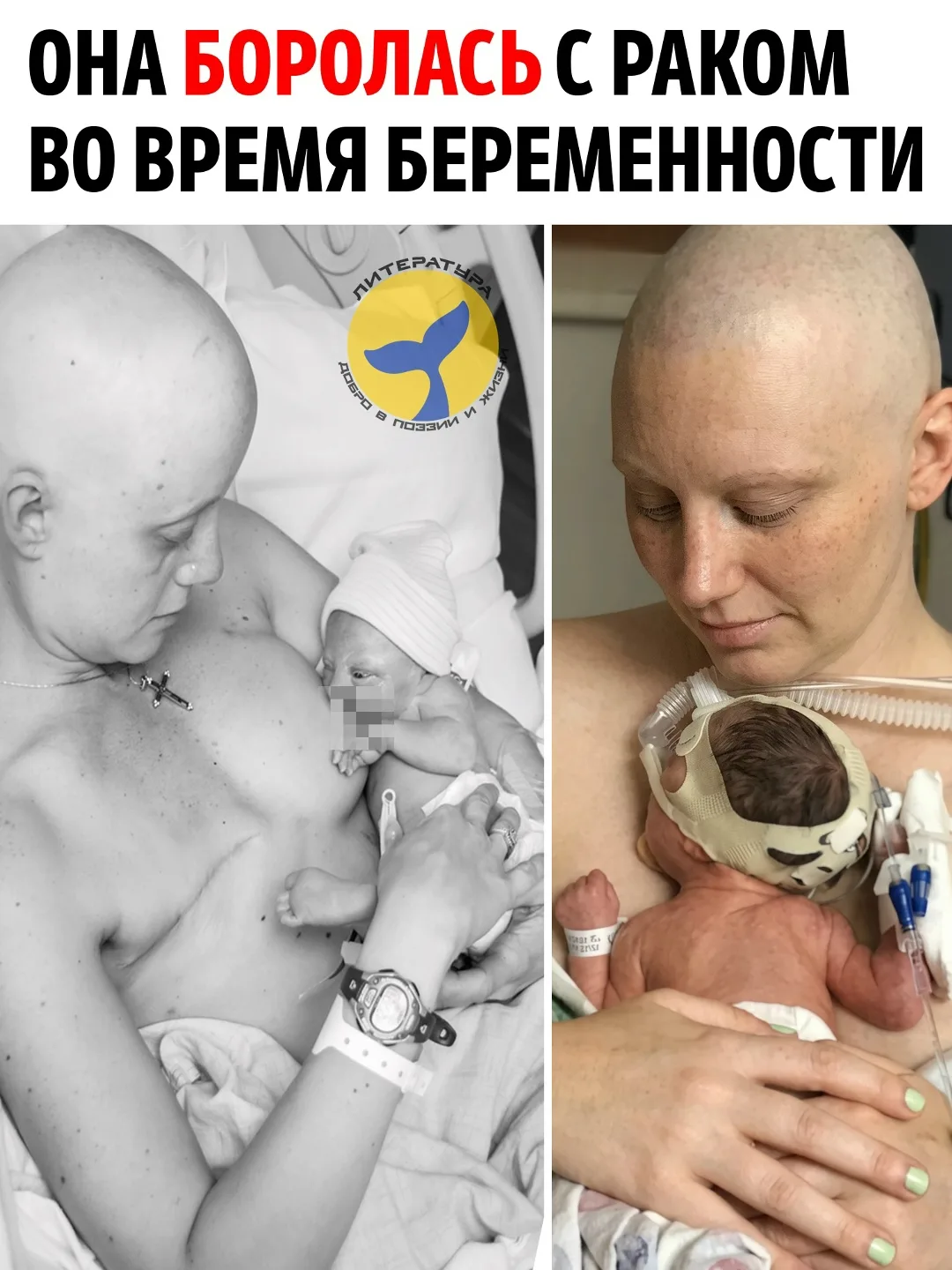 В 2015 году Сара Уитни узнала, что у неё рак молочной железы III стадии. Диагноз постав...