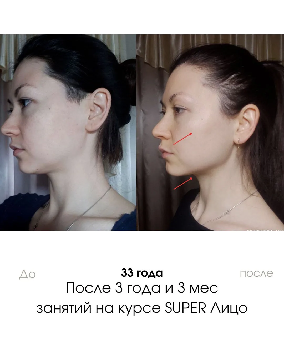 Изображение 1 к публикации «Гимнастика для лица»