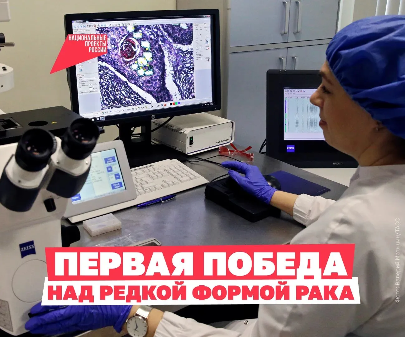 Необычное решение врачей избавило от страшной болезни 👩‍⚕