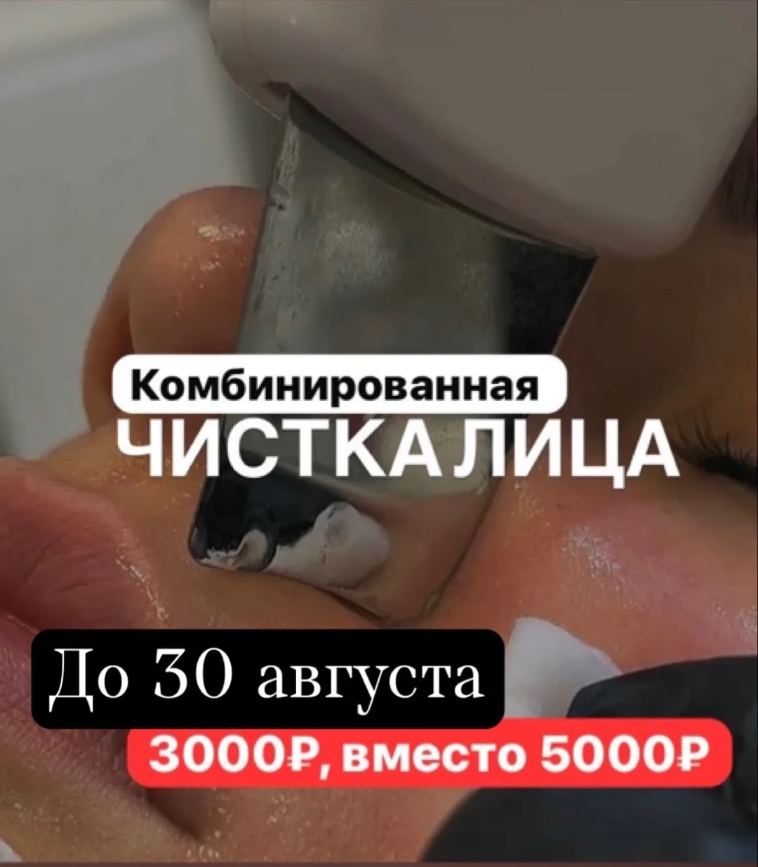 Чистка лица за 3000₽, вместо 5000₽