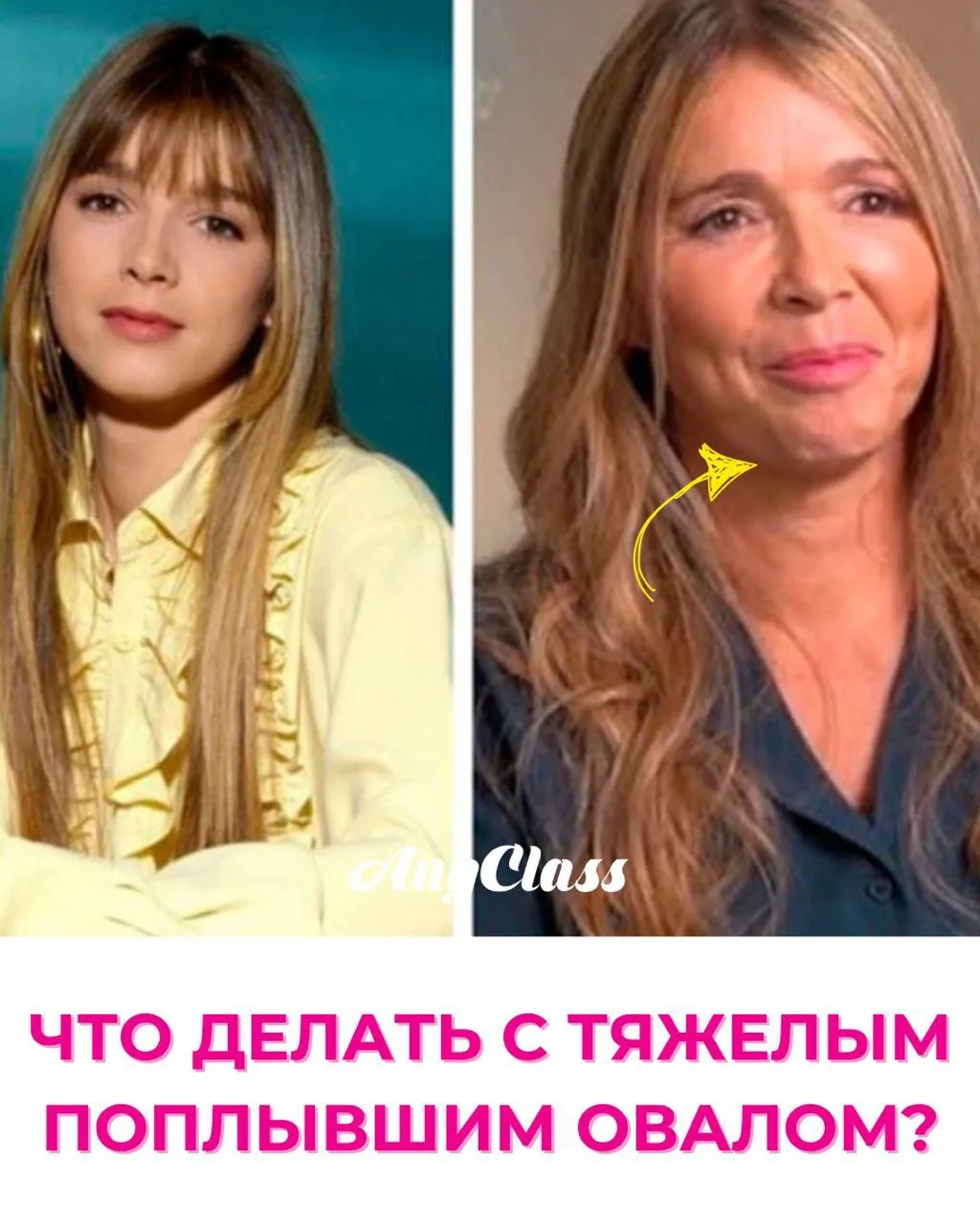 🫠 ЛИЦО ПОПЛЫЛО ВНИЗ?