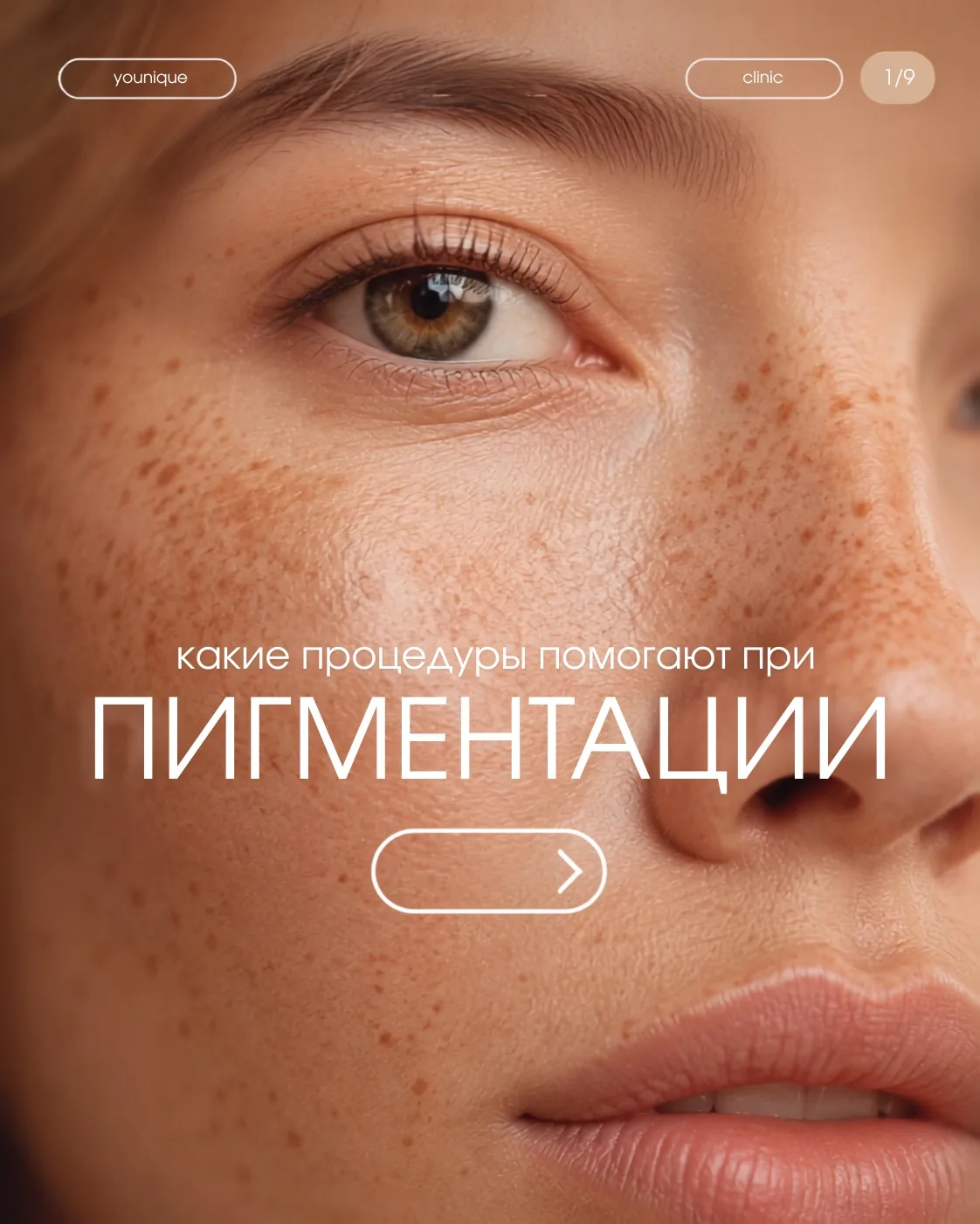 ✨ Август — самое время заняться пигментацией
