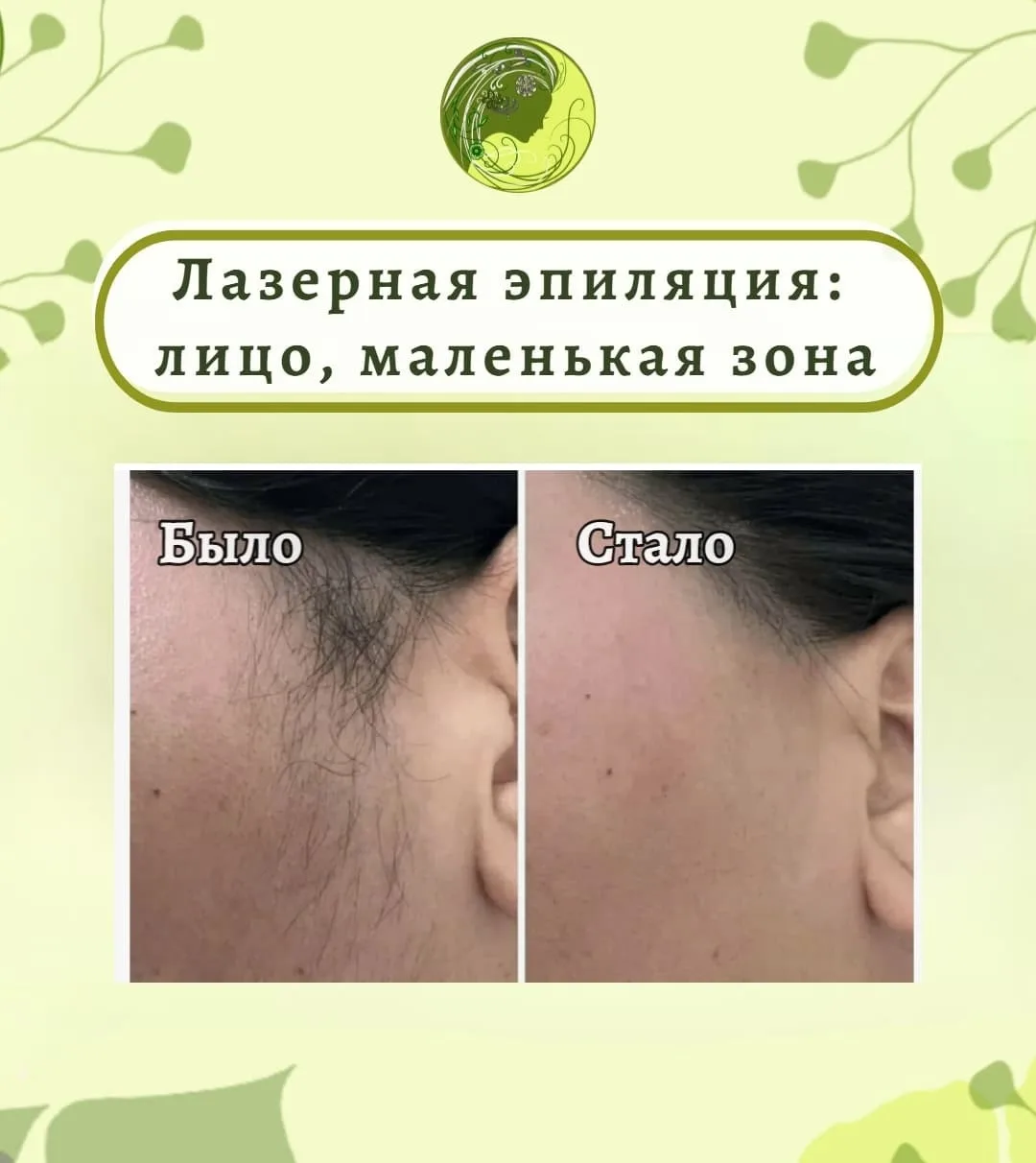 🧩 Зона: лицо ( маленькая зона)