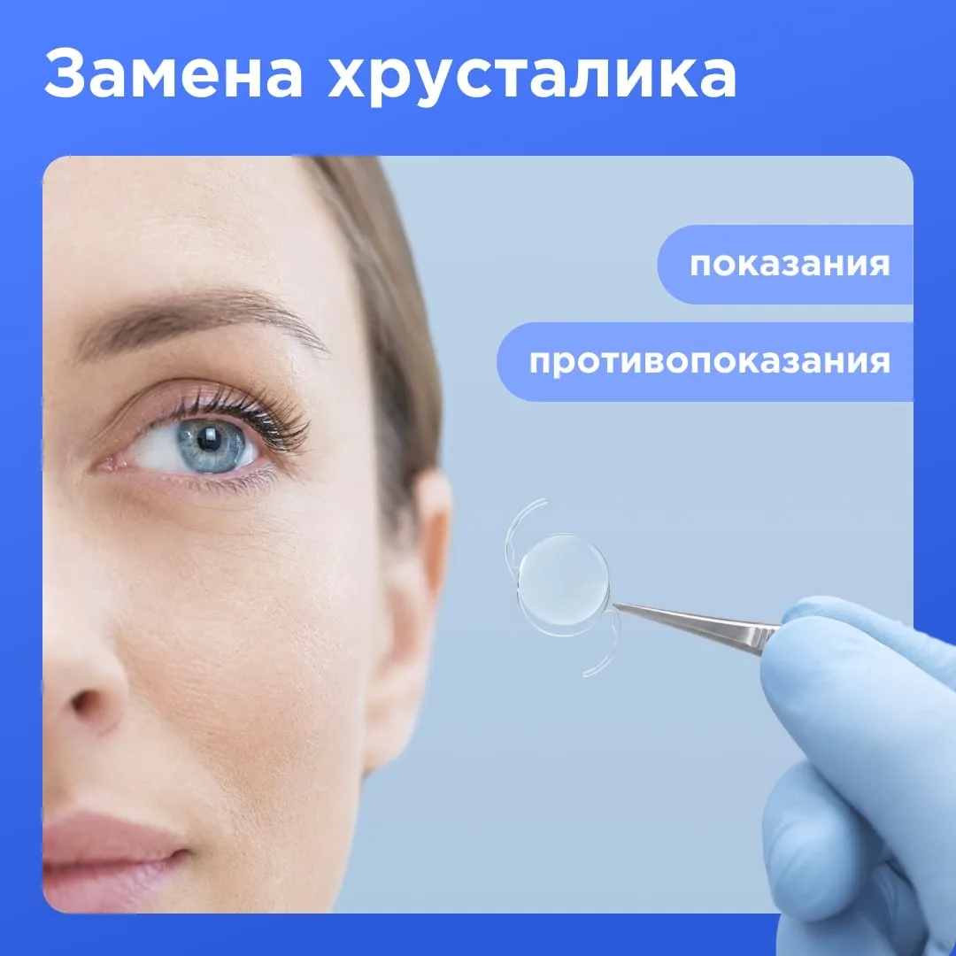 Замена хрусталика: показания и противопоказания