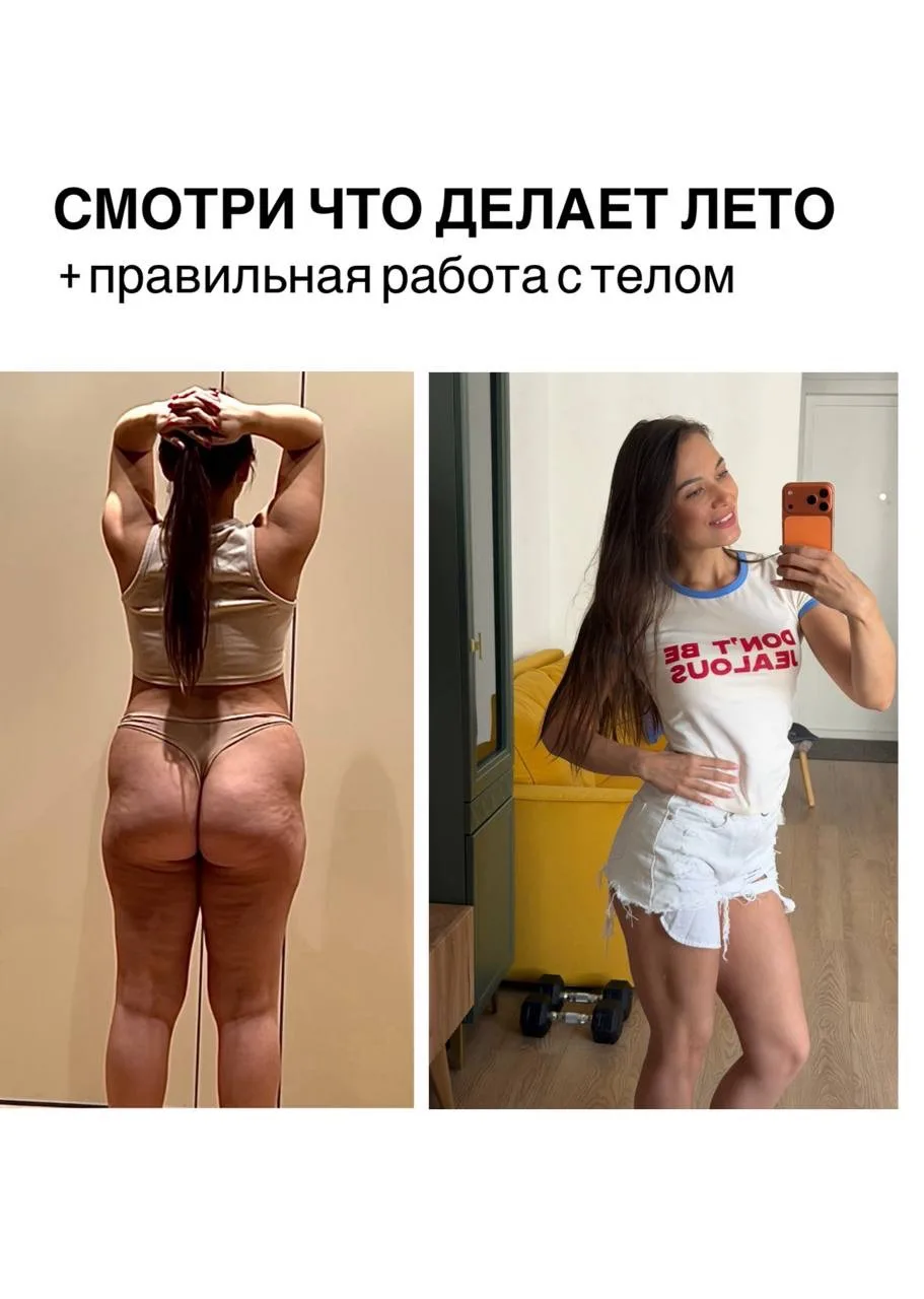 Целлюлит… с ним сталкиваются 90% женщин и каждая мечтает от него избавиться… Летом на с...