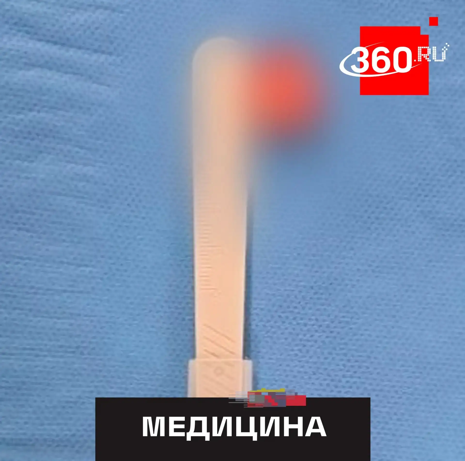 Комар заразил подростка червем-паразитом.