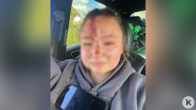 На меня набросились вдвоём: 22-летней калининградке пробили голову гаечным ключом во вр...