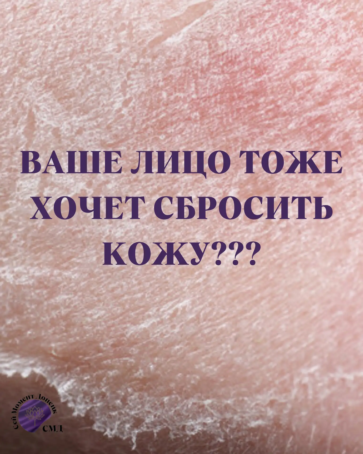 🐍 ВАШЕ ЛИЦО ТОЖЕ ХОЧЕТ СБРОСИТЬ КОЖУ???