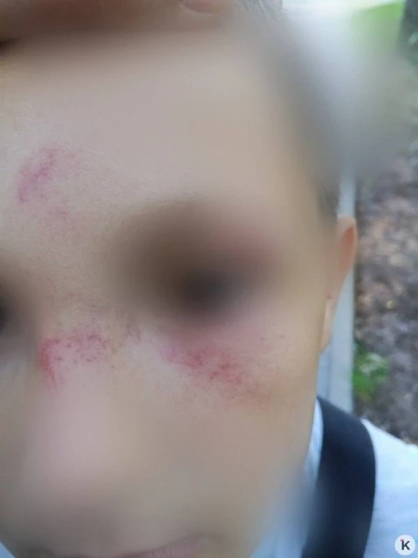 👊🏻 В Васильково женщина ударила 8-летнего мальчика, обидившего её дочь.