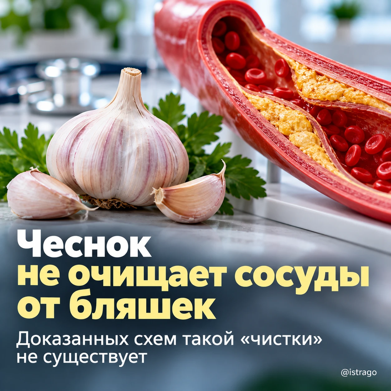Чеснок не «очищает» сосуды от холестериновых бляшек