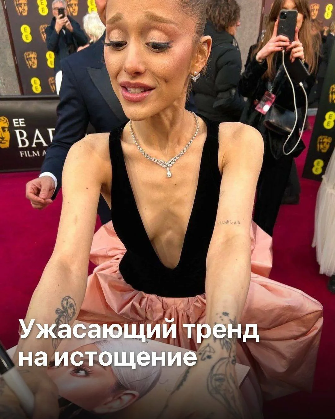 😱😭 тренд на нездоровую худобу