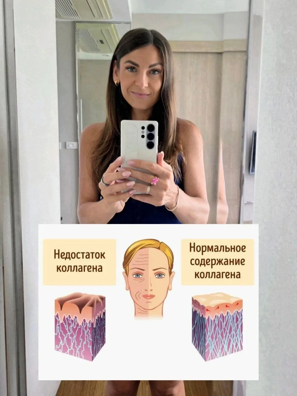 ✅ 5 простых продуктов, которые стимулируют выработку коллагена

Коллаген – это наша молодость. Это б