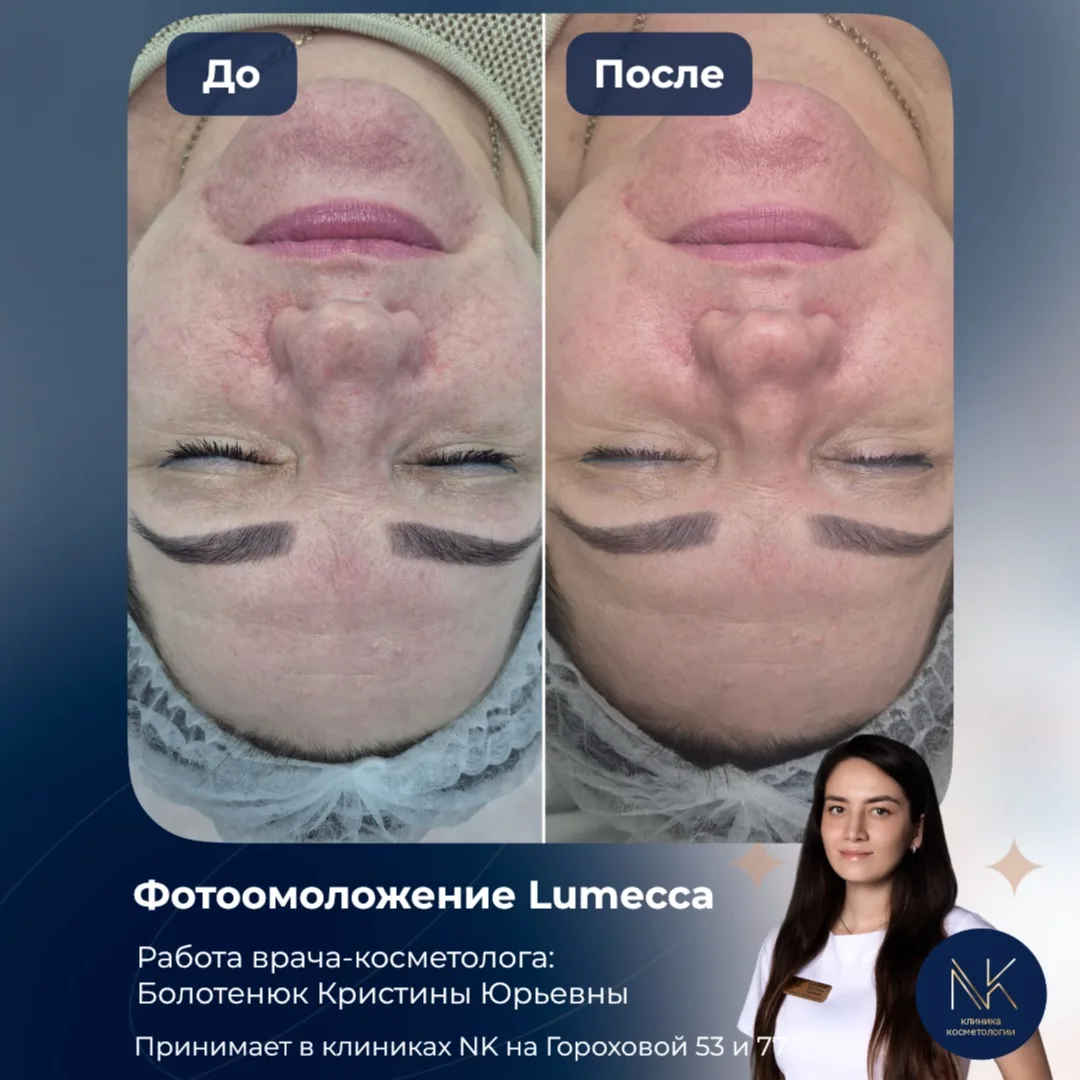 😫«Я просто хочу выйти из дома без тонального крема...»