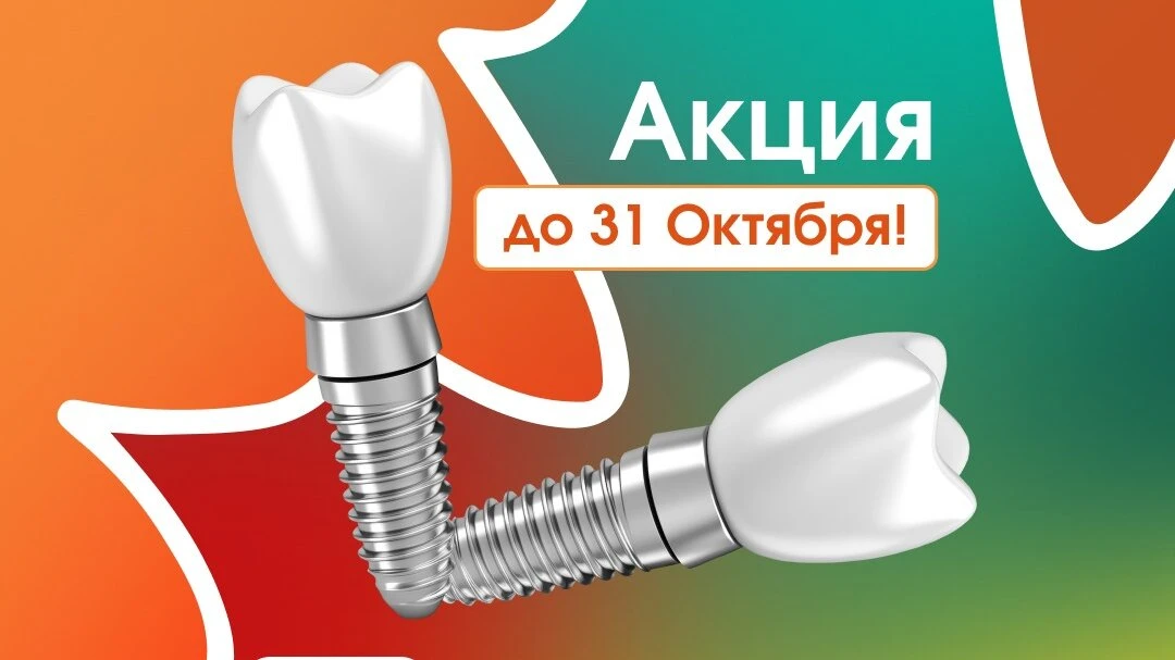 Имплантация зуба в Москве — осенняя Акция уходящего года