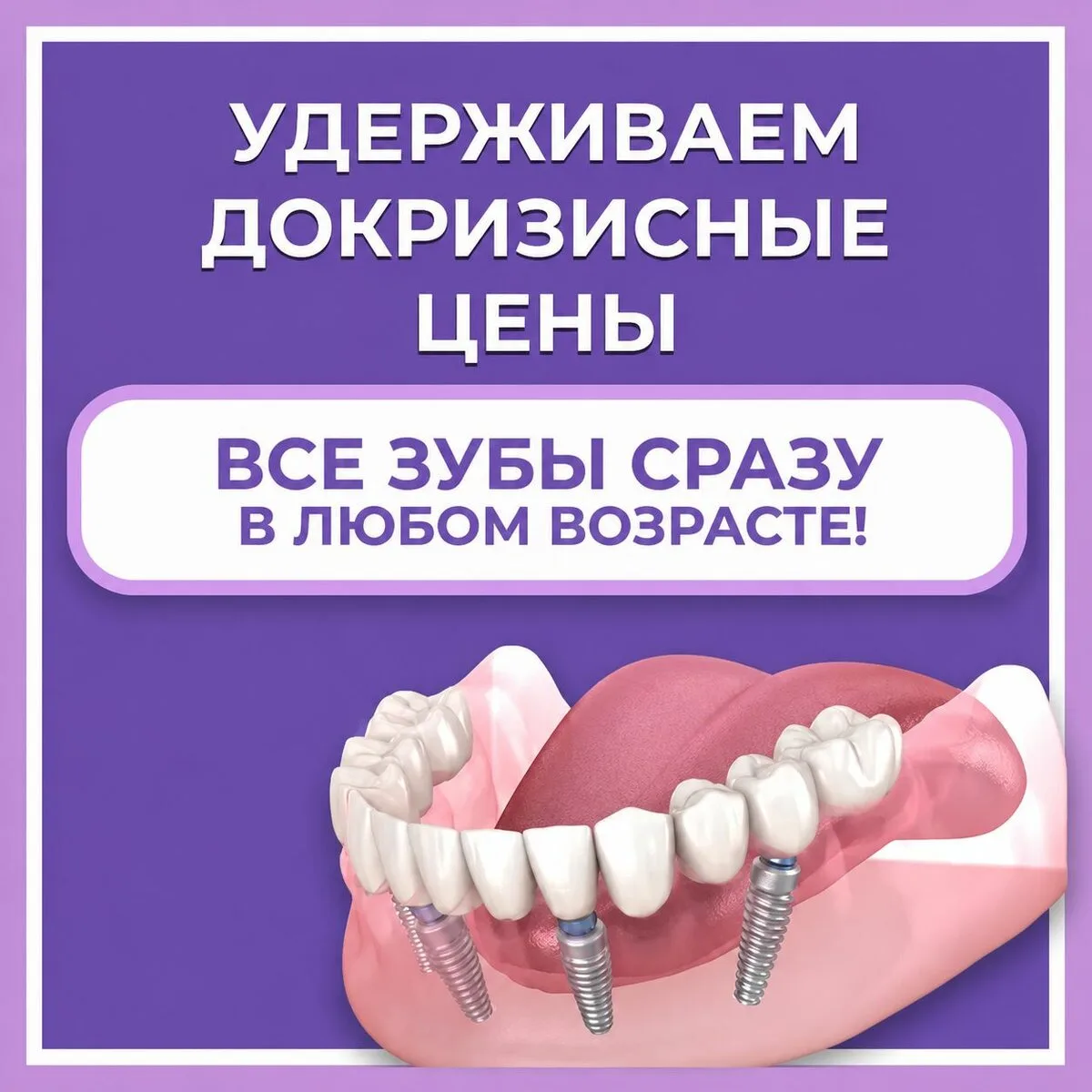 Несъёмный протез на 4-х имплантах за 1 день
