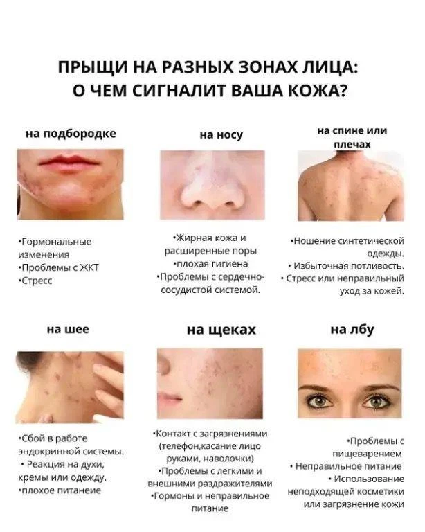 Кожа - это зеркало внутреннего состояния организма.