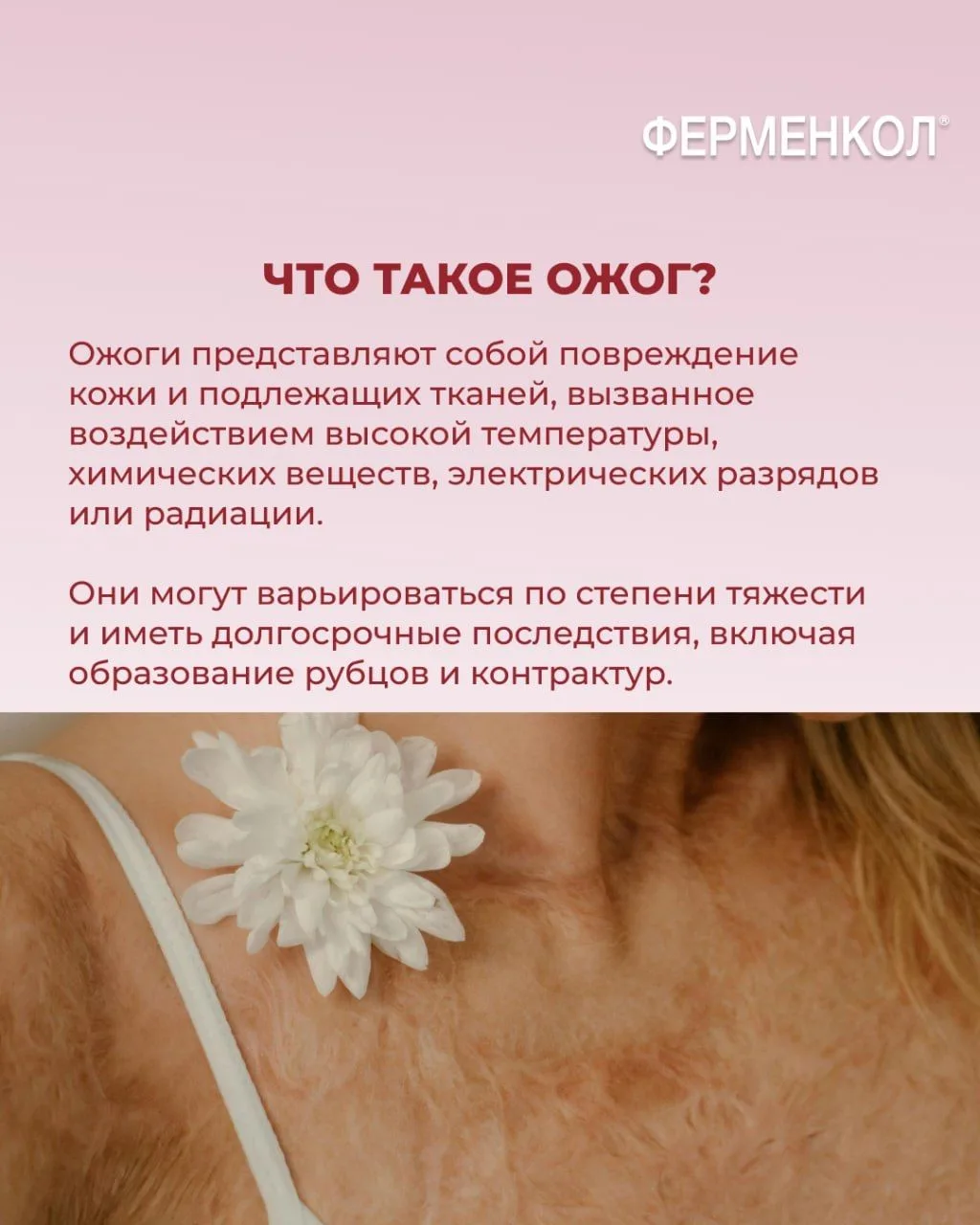 Шрамы после ожогов — не столько вопрос эстетики, сколько здоровья и качества жизни паци...
