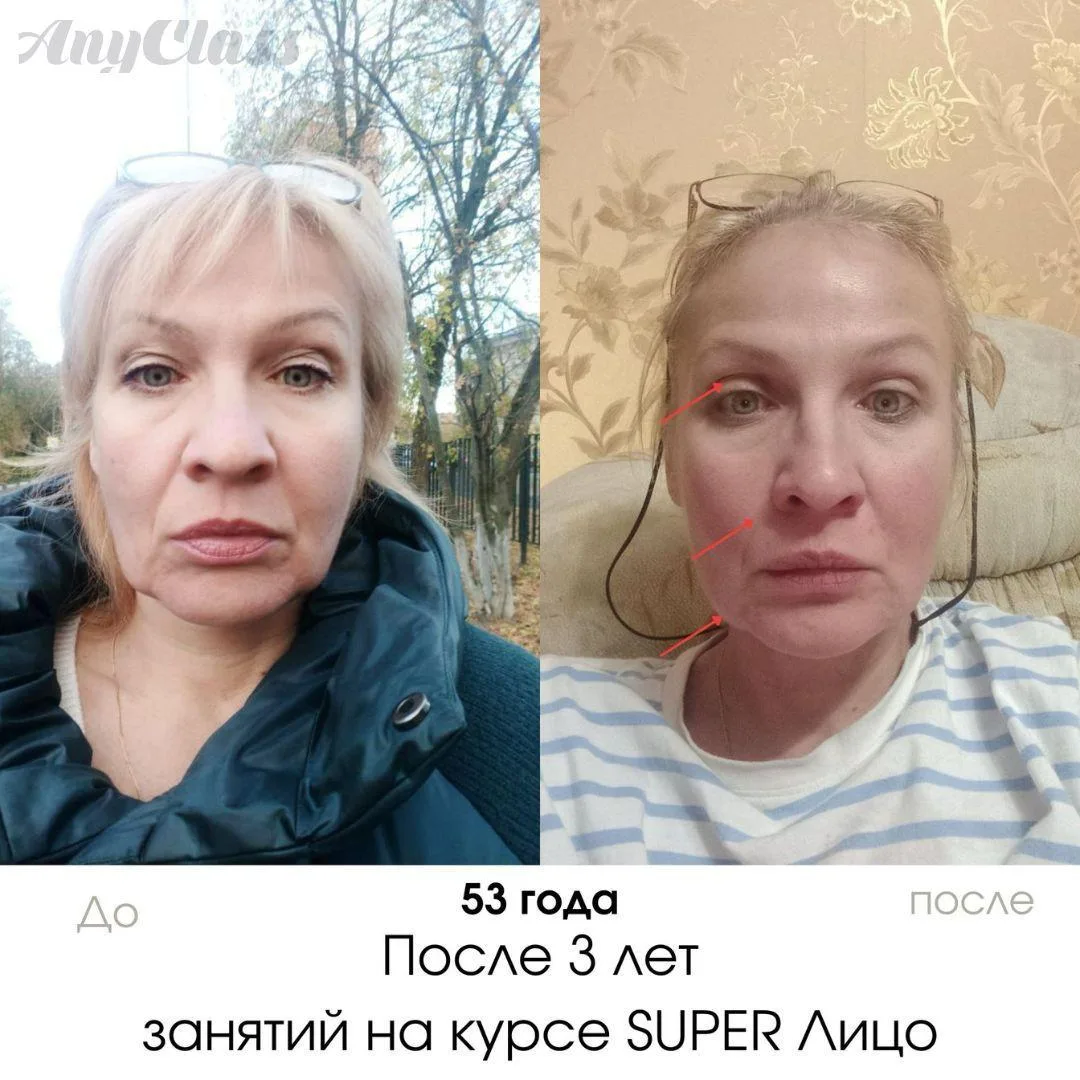 «Я не верю в гимнастику для лица! И не верю, что вы ничего с собой не делали» ⚠️ Гимнастика для лица
