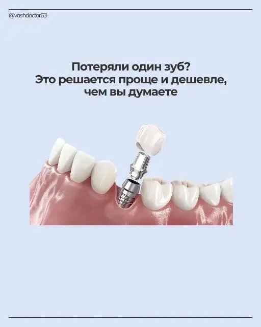 Потеряли один зуб? Это решается проще и дешевле, чем вы думаете