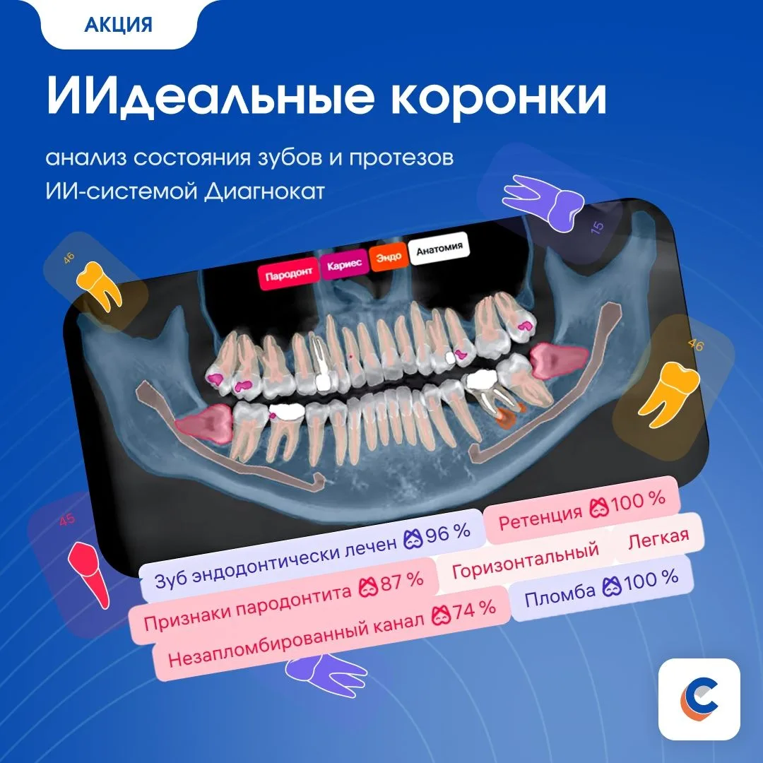 ИИдеальные коронки: анализ состояния зубов и протезов ИИ-системой Диагнокат всего за 55...