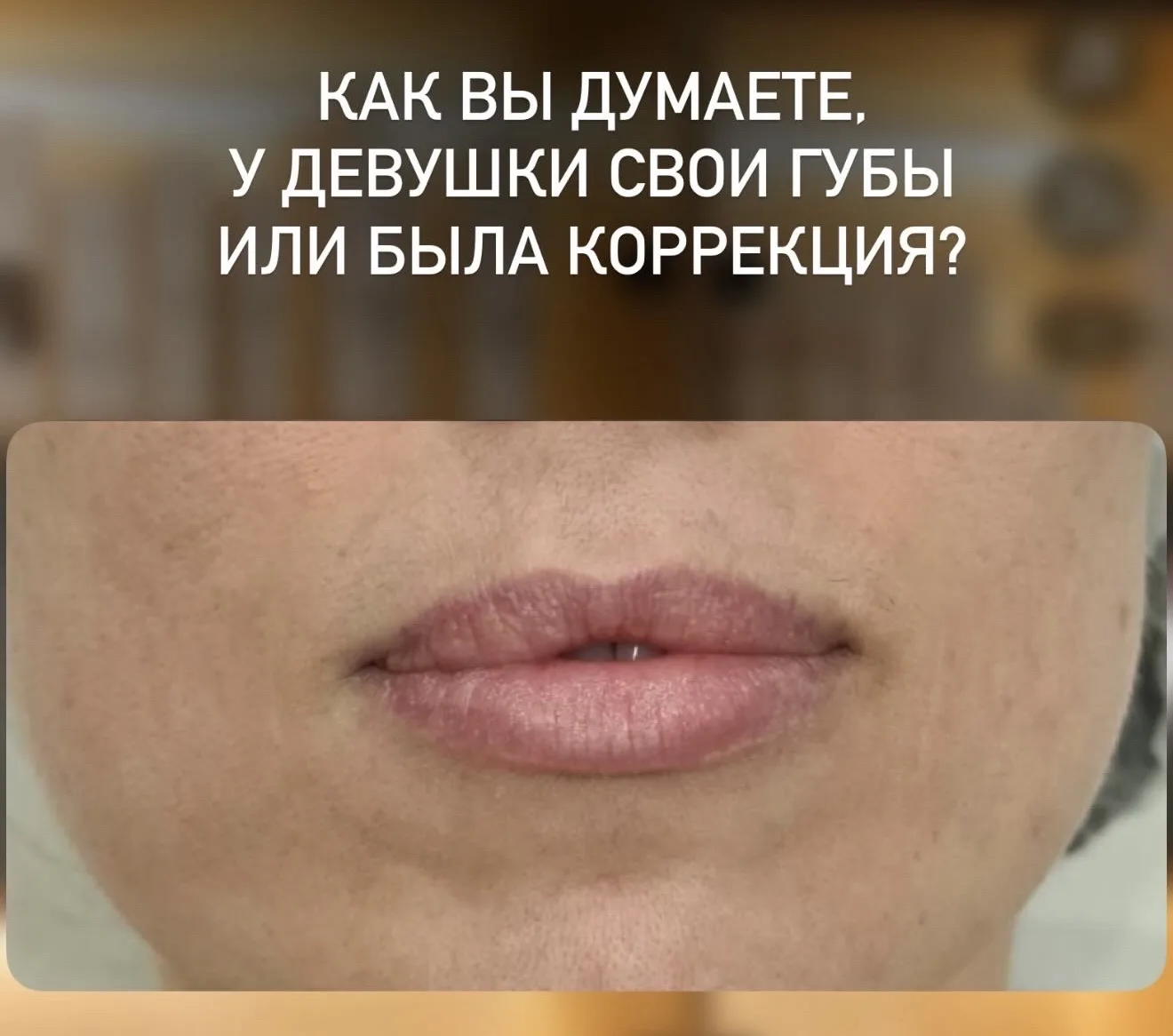 Как вы думаете, здесь была коррекция или губы натуральные?