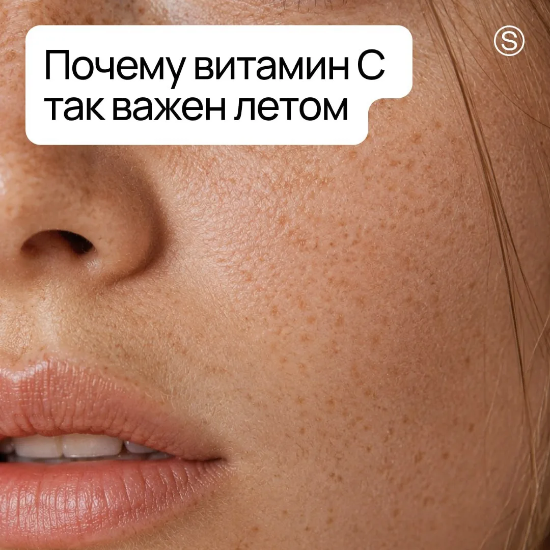 Солнце всё чаще светит, УФ-индекс растёт, а в коже активизируется тирозиназа — фермент,...