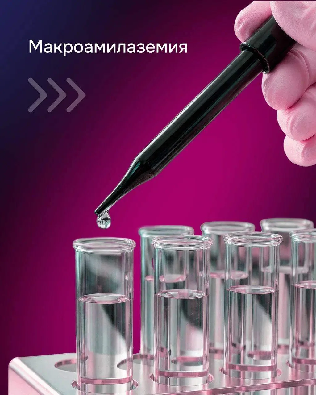 Макроамилаземия. Клиническая значимость.