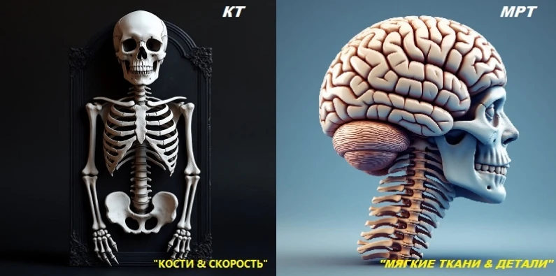 КТ vs МРТ: что выбрать? Объясняем разницу на пальцах. Врач назначил вам КТ или МРТ, и в...