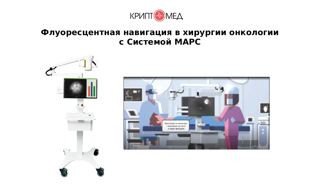 💥Флуоресцентная навигация в хирургии онкологии с Системой для проведения флуоресцентно...