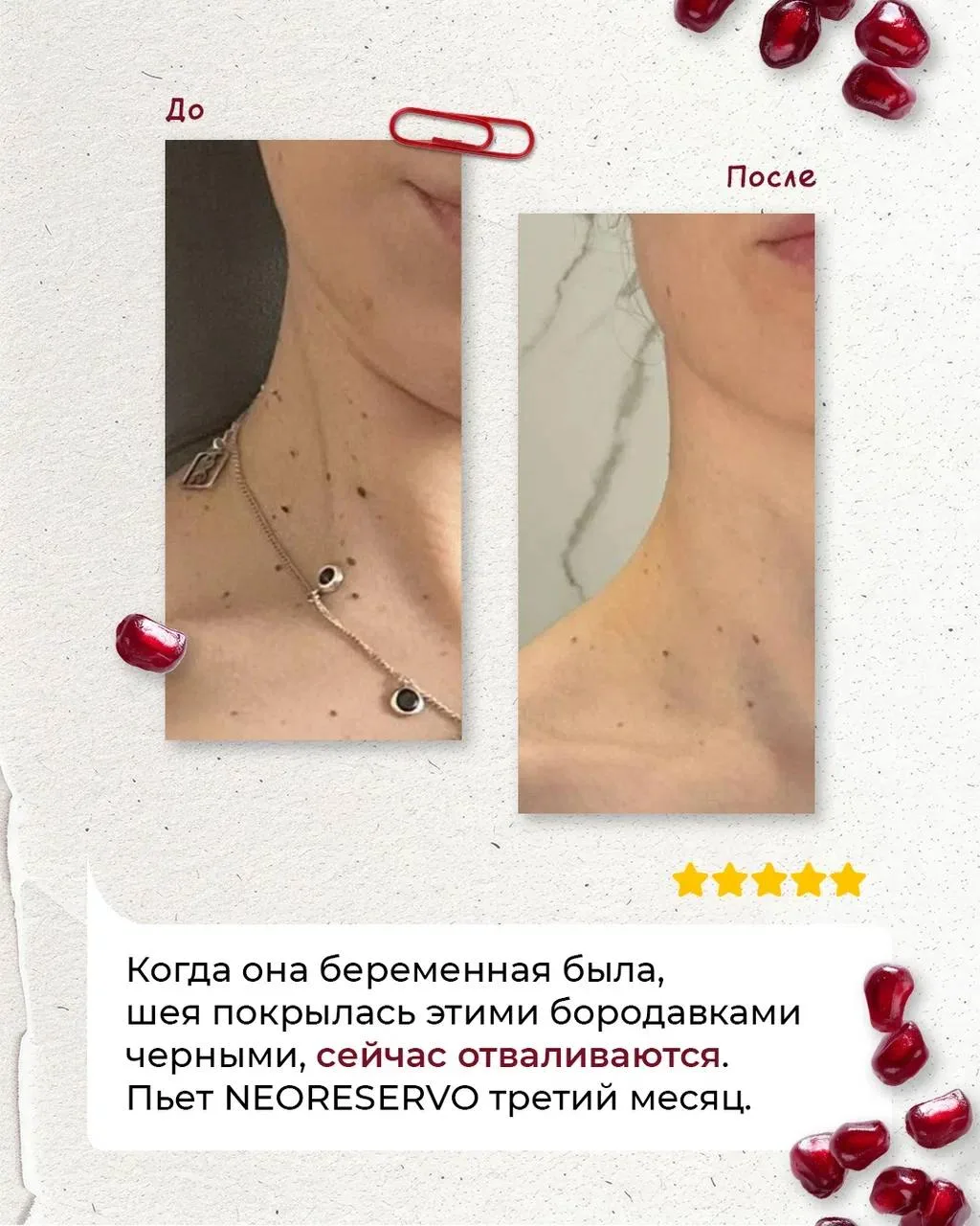 РЕАЛЬНЫЕ ИЗМЕНЕНИЯ С NEORESERVO🍀  Мы собрали ваши отзывы о нашем флагмане🍀, и тут правда есть на что