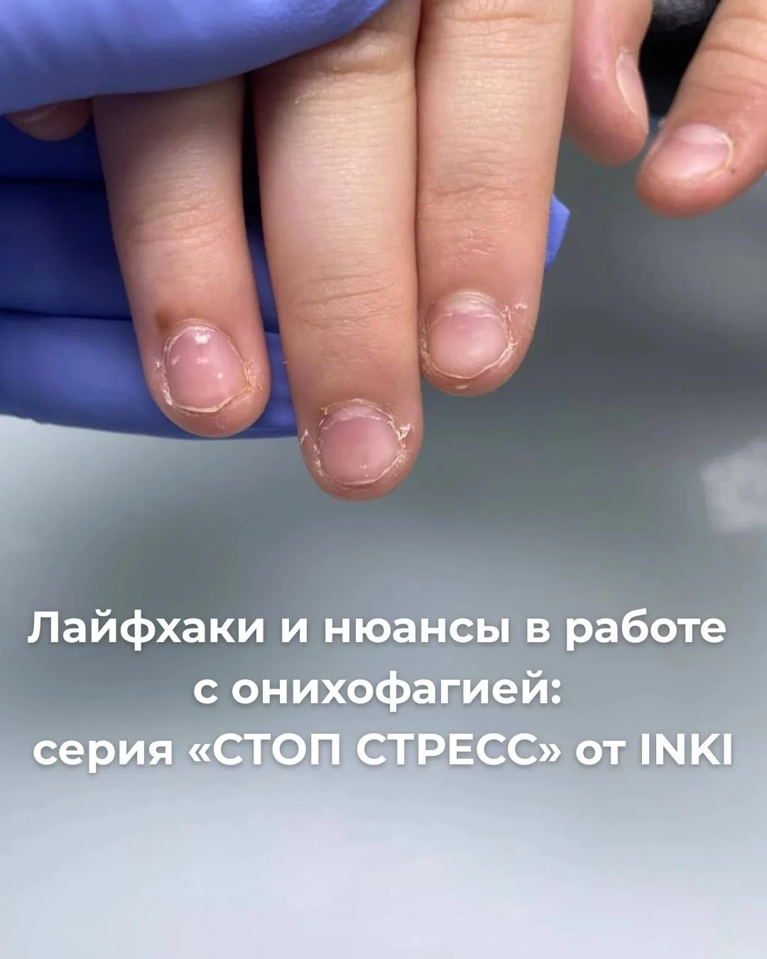 Как помочь избавиться от привычки грызть ногти — без давления и наказаний 💜