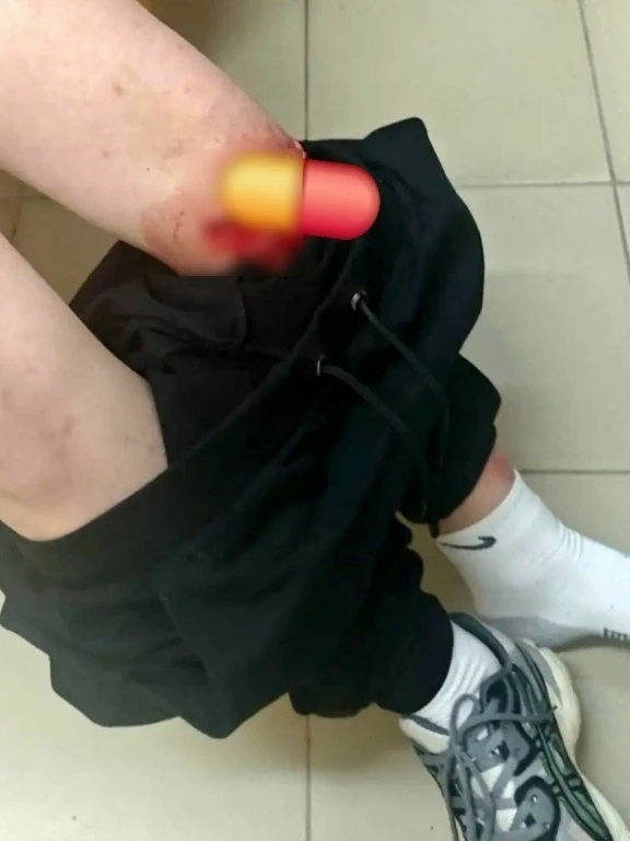 Фото не для слабонервных‼