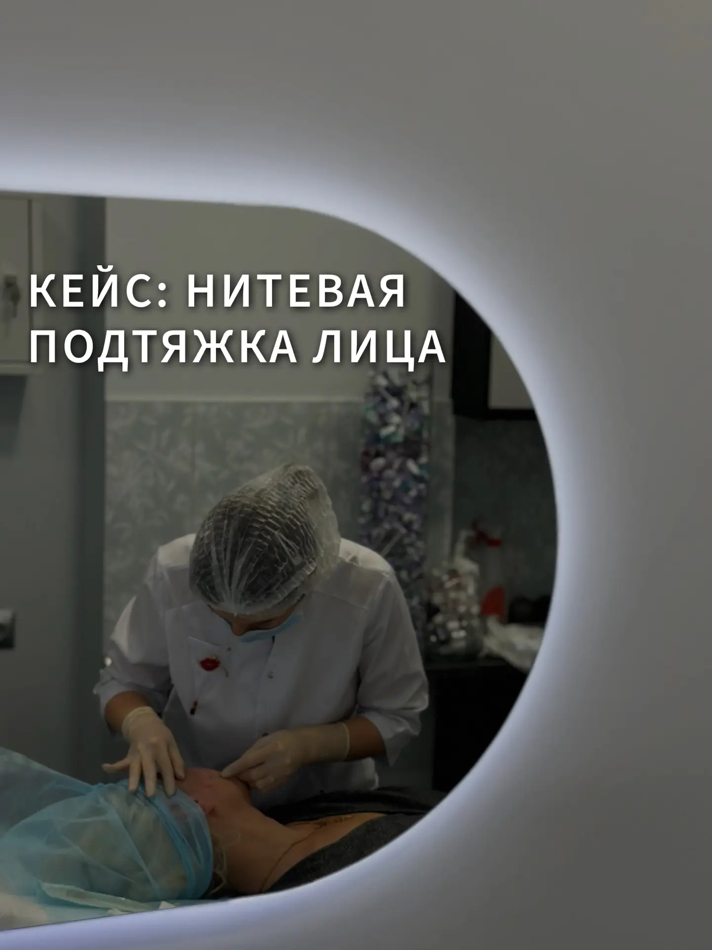 📌 Кейс: Нитевой лифтинг как возможность вернуть четкость овала лица без хирургического...