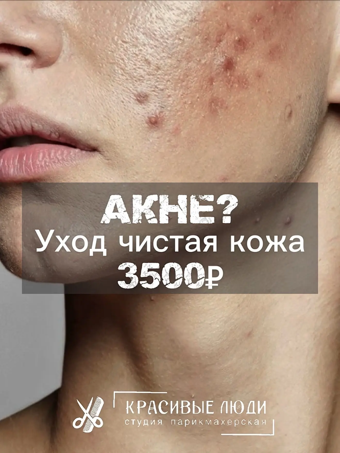 Чистая кожа - реально 🔬✨