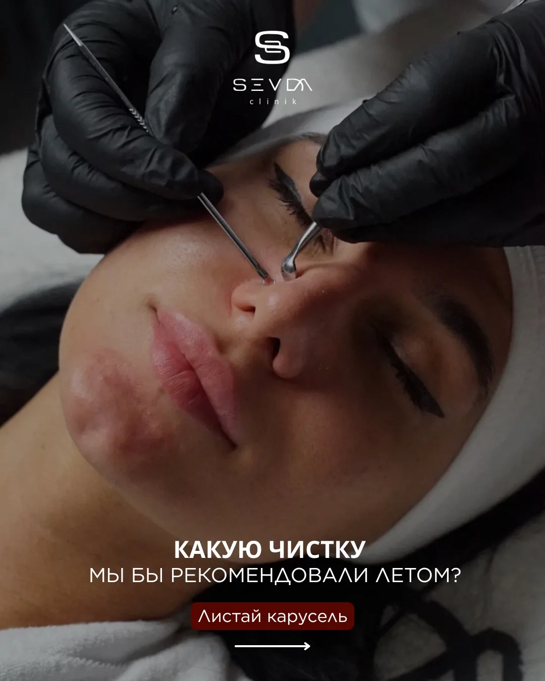 Какая чистка лица идеально подходит для лета? ☀️✨