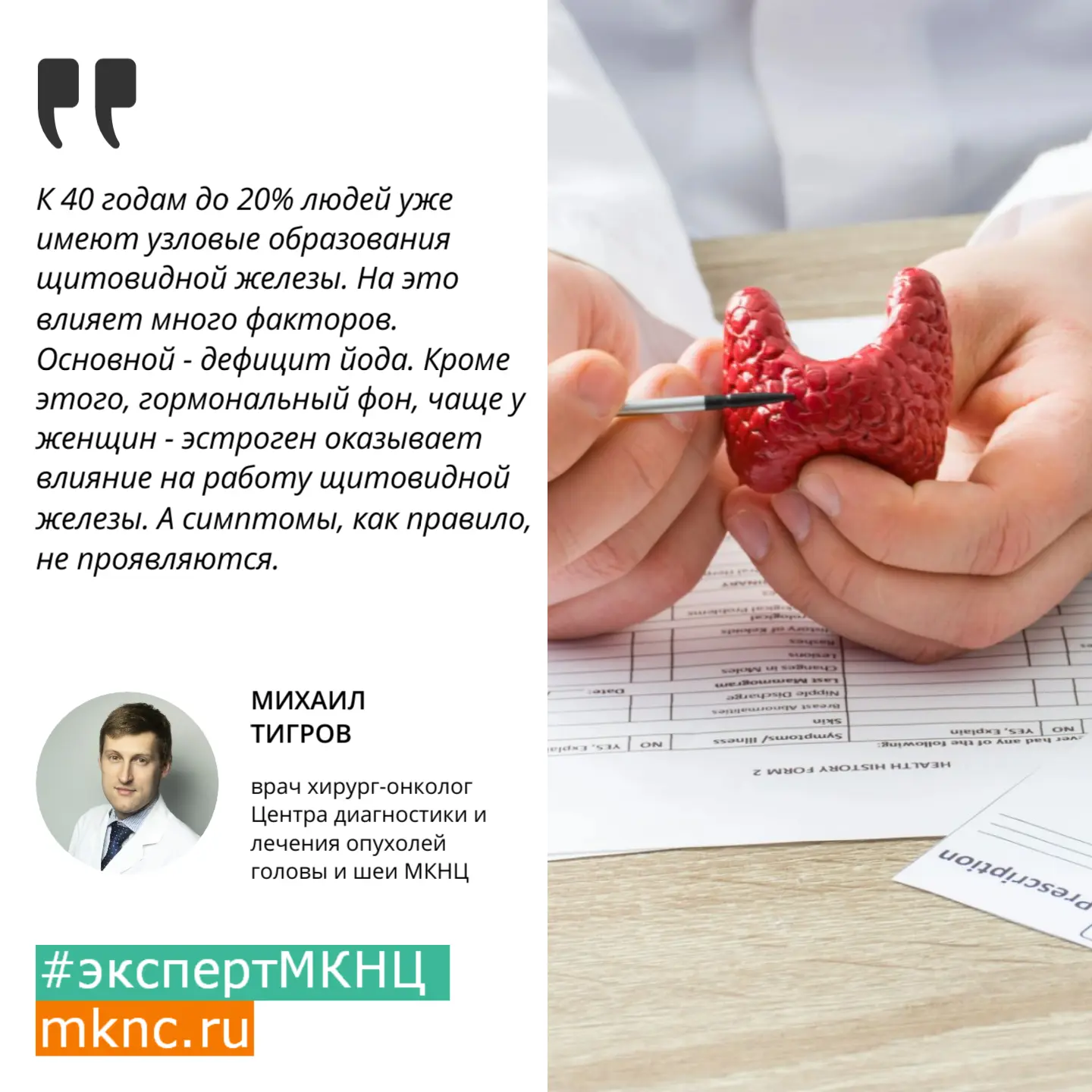 Щитовидную железу часто называют «дирижёром» организма, она играет ключевую роль в регуляции множест
