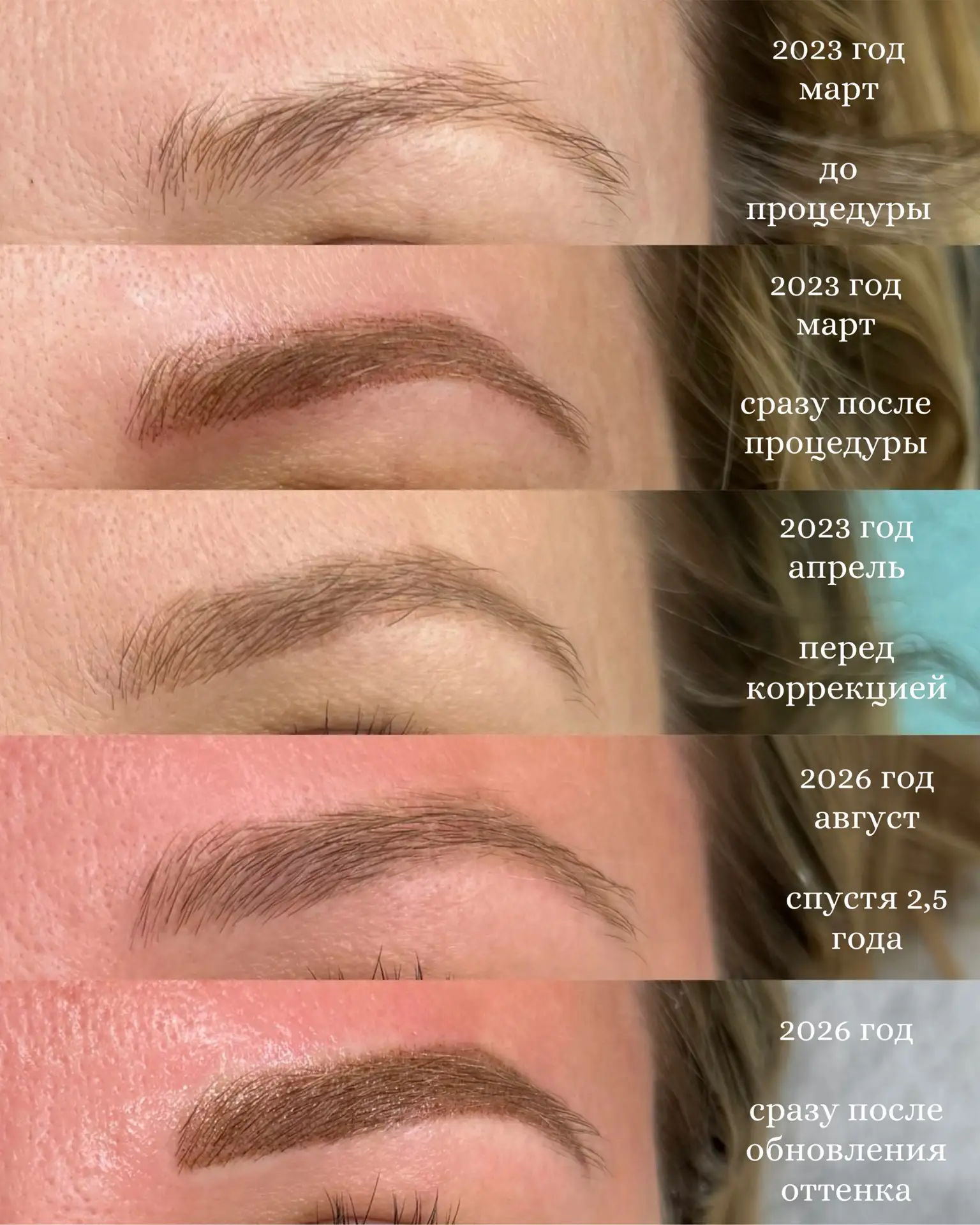 Девушка впервые пришла ко мне в 2023 году. Тогда у неё был старый остаток от предыдущег...